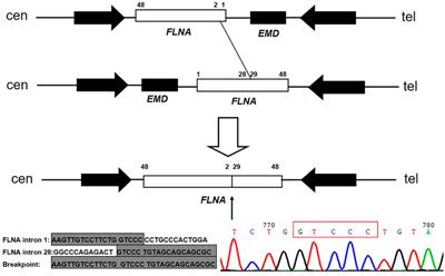 Microhomology-Mediated Nonhomologous End Joining Caused Rearrangement of EMD and FLNA in Emery-Dreifuss Muscular Dystrophy